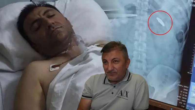 15 Temmuz’un Unutulmaz Yüzü: Vücudunda Kurşunla Yaşayan Kahraman
