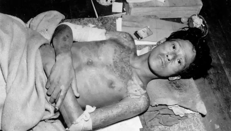 80 Yıl Sonra Nagasaki’den Gelen Uyarı: Nükleer Felaket Bizleri Bekliyor!