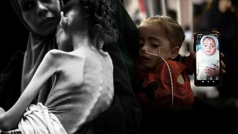 Küçük Meryem'in Dramatik Düşüşü: 25 Kilodan 10 Kiloya Mücadele
